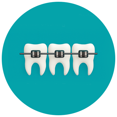 Orthodontics Treatment